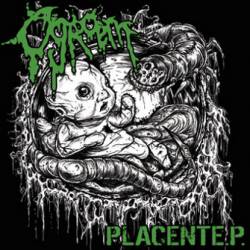 Placent EP